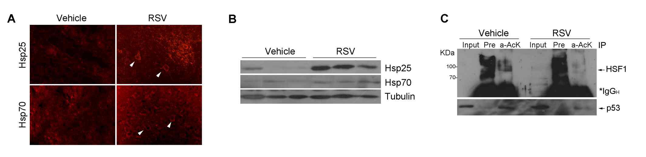 RSV에 의한 G93A 생쥐 척수에서의 hsp 발현 증가 및 HSF1 탈아세틸화