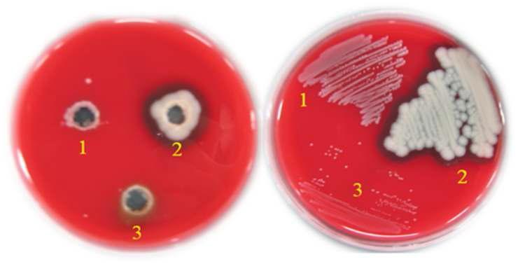 The hemolysis test against sheep blood agar plates. 1 : E.coli DH5 ａ, 2 : Bacillus cereus KCTC 3624 , 3 : L. lactis subsp. lactis I2