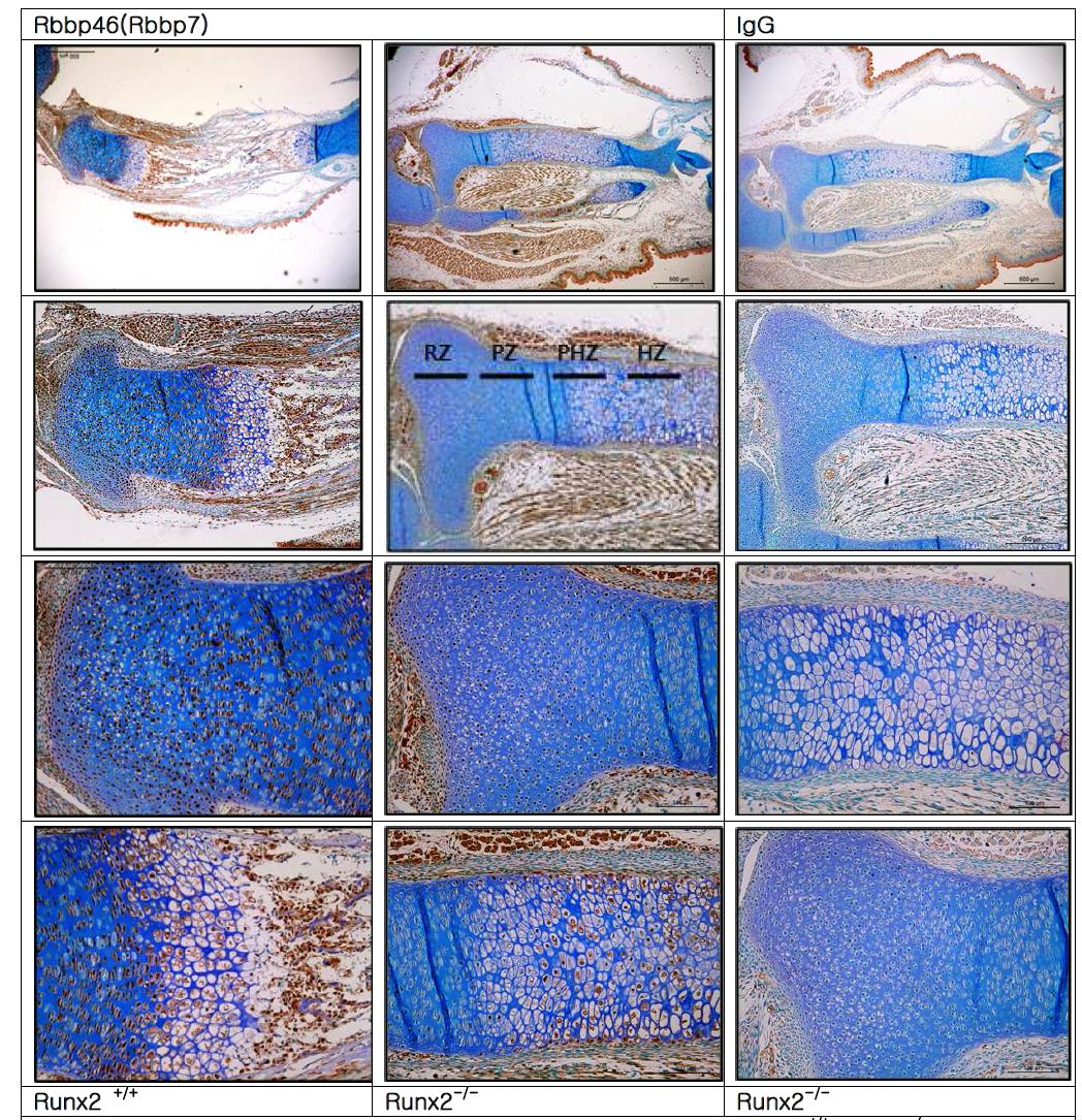 Histological analysis and RBBP7 expression of the entire tibia from Runx2+/+ , Runx2-/-Mice at E17.5.prehyperchondrocytes and hyperchondrocytes showed a little expression of RBBP7 in Runx2 null micecompared wild mice.