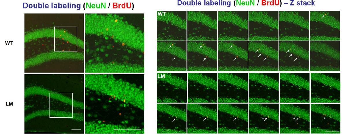 WT과 LM의 해마신경재생성을 double labeling으로 관찰한 결과.