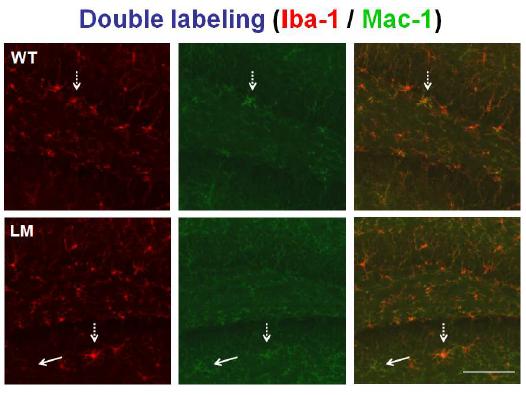 WT과 LM의 glia activation을 double labeling으로 관찰한 결과.