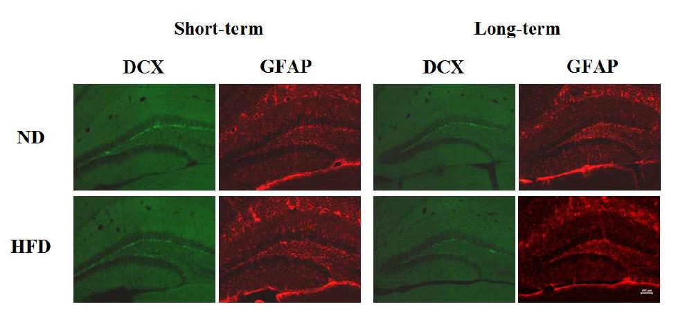 정상식이와 고지방식이를 섭취한 생쥐의 해마에서 immature neuron marker인 DCX (green)와 astrocyte marker인 GFAP (red)를 면역염색결과.