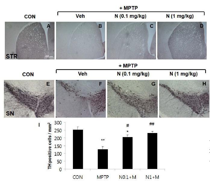 STR과 SN 부위를 THimmunostaining을 통해 dopaminergic neuron을 관찰함.