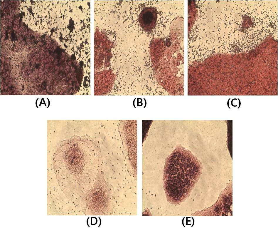 Microscopic views of adhesion to Caco-2 cell lines after washing steps (A) L. pentosus PL11, (B) L. plantarium PL13, (C) E. tarda, (D) S. iniae, (E) Control.