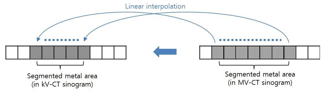 MV-CT sinogram 의 금속 정보가 kV-CT sinogram 에 삽입되는 원리