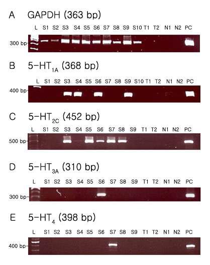 5-HT에 의해 유발되는 과분극 및 탈분극에 관여하는 수용체 아형을 규명하기 위해 single cell RT-PCR을 시행하였다. 미측소핵 SG 신경세포에 여러 종류의 5-HT 수용체 아형들이 발현함이 확인되었다 (좌측 그림은 미성숙기 마우스에서 얻은 것임).