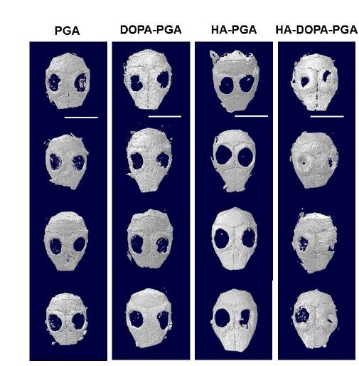 Micro-CT를 통한 마우스 두개골 결손 모델에 이식된 PGA, DOPA-PGA, HA-PGA, 그리고 HA-DOPA-PGA의 골 전도 능력 분석. 스케일바는 10mm를 나타낸다.