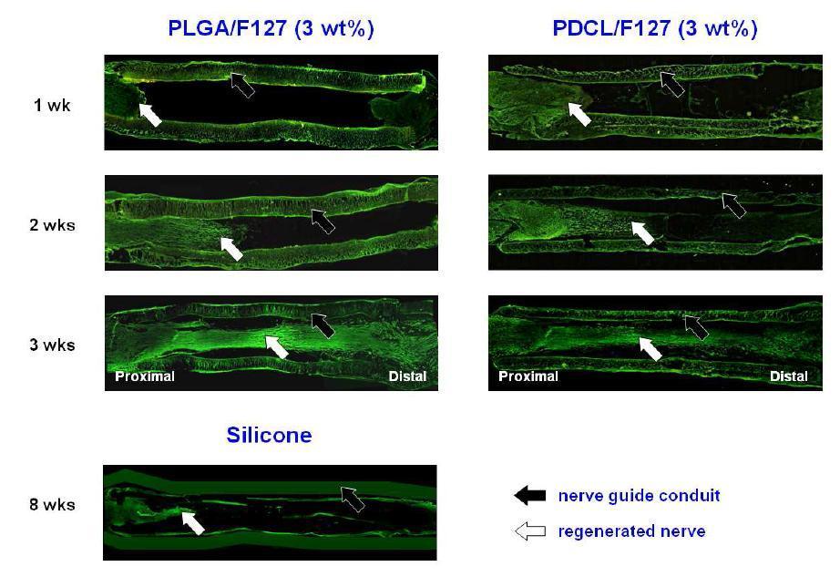 PLGA/F127 및 PDCL/F127 신경유도관을 통한 신경의 재생거동 (anti-neurofilament staining, x 4).