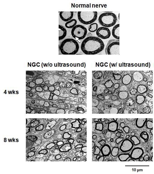 신경유도관/초음파 자극을 통해 재생된 신경의 단면 사진 (신경유도관의 중앙부, TEM, x 3,000; 화살표, 마이엘린; *, 엑손).