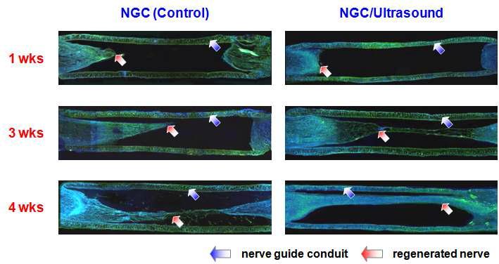 신경유도관 및 신경유도관/초음파자극에 의한 신경의 재생거동 (anti-neurofilament/hoechst staining, x 4).