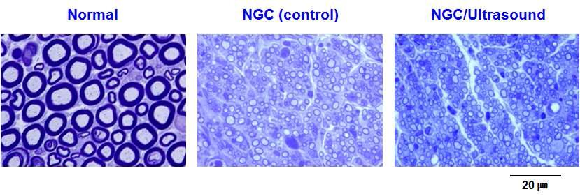 신경유도관 및 신경유도관/초음파자극에 의해 재생된 신경의 단면 사진 (Toluidine blue staining, 4 wks, x 1,000).