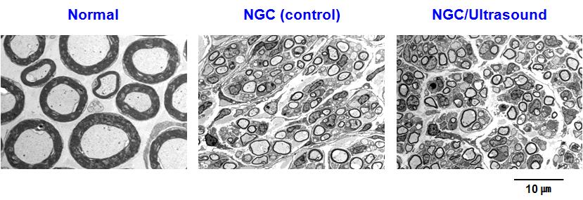 신경유도관 및 신경유도관/초음파자극에 의해 재생된 신경의 단면 사진 (TEM, 4 wks, x 3,000).