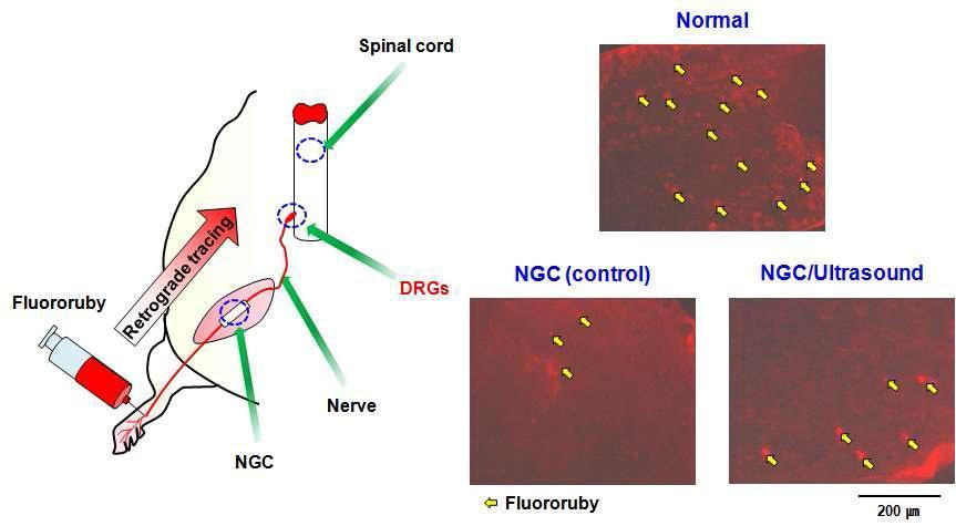 신경유도관 및 신경유도관/초음파자극에 의해 재생된 신경의 Fluororuby 역행 추적 결과 (화살표, Fluororuby; DRGs 부위, 4 wks, x 400).