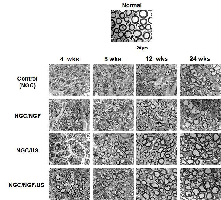 신경유도관, 신경유도관/성장인자, 신경유도관/초음파 및 신경유도관/성장인자/초음파 자극에 의해 재생된 신경의 단면 사진 (TEM, x 3,000).