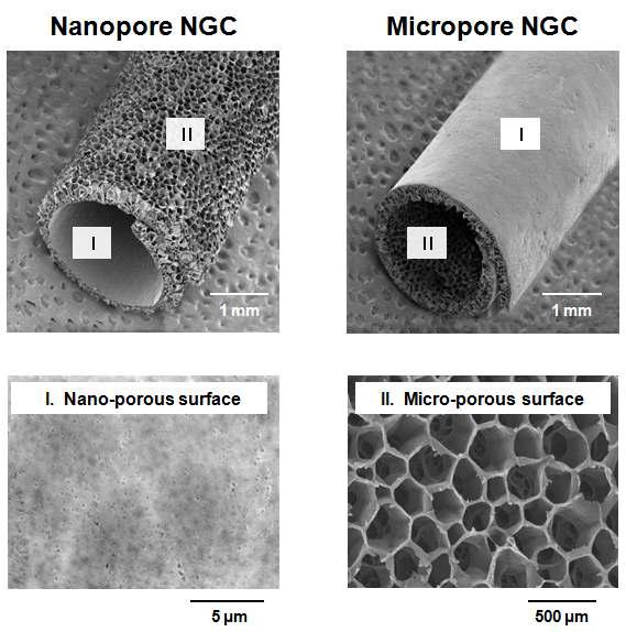 본 연구팀에서 제조한 서로 다른 다공 구조를 가지는 신경유도관의 SEM 사진 (나노 다공 표면 vs. 마이크로 다공 표면).