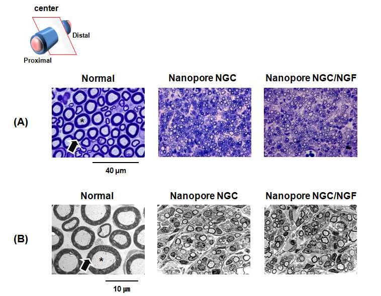 나노 다공 신경유도관 및 마이크로 다공 신경유도관을 통해 재생된 신경의 단면 사진. (A) Toluidine blue staining (x 1,000) 및 (B) TEM (x 3,000) (4 wks).