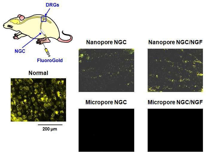 나노 다공 신경유도관 및 마이크로 다공 신경유도관을 통해 재생된 신경의 Fluorogold 역행 추적 결과 (DRGs 부위, 4 wks, x 400).