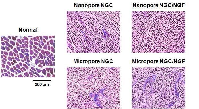 나노 다공 신경유도관 및 마이크로 다공 신경유도관을 통해 재생된 신경에 의한 근육의 위축정도 평가 사진 (gastrocnemius muscle 부위, 4 wks, x 200).