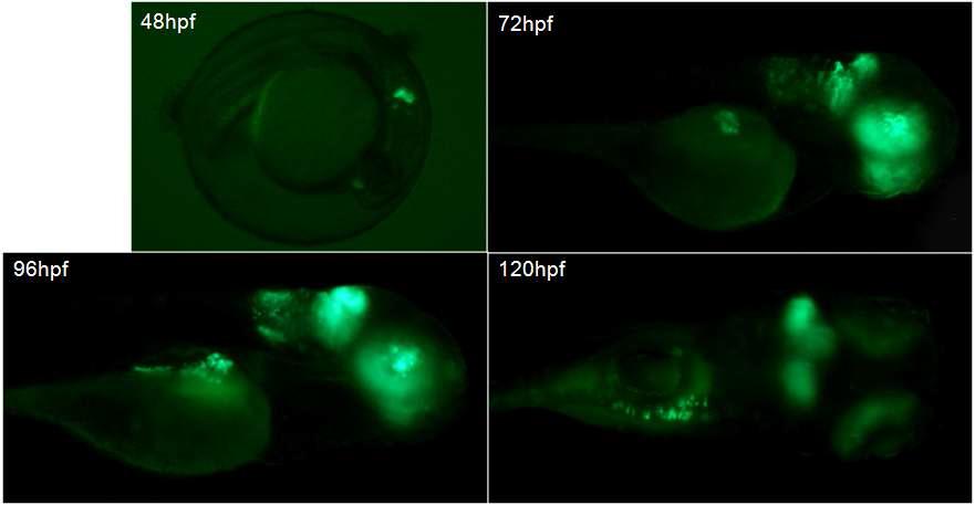 Ptf1a domain에 Ihha를 발현하는 형질전환주. Ptf1a domain인 hindbrain, retina, pancreas에 biomarker GFP가 발현되고 있음.