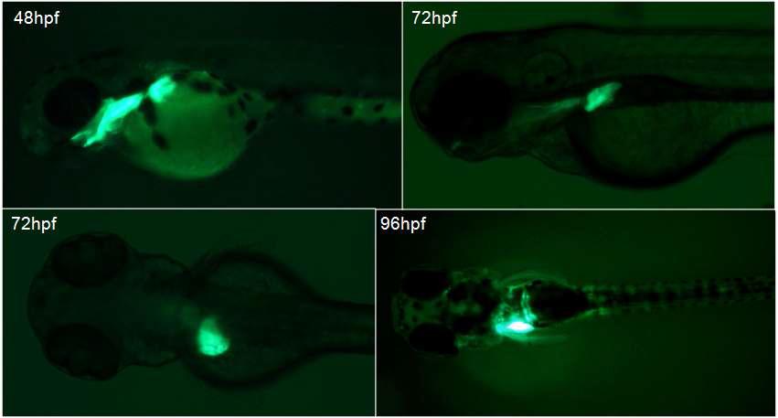 LFABP domain에 GFP를 발현하는 형질전환주. LFABP는 간특이적으로 발현되는 fatty acid binding protein임. LFABP-GFP line은 control.