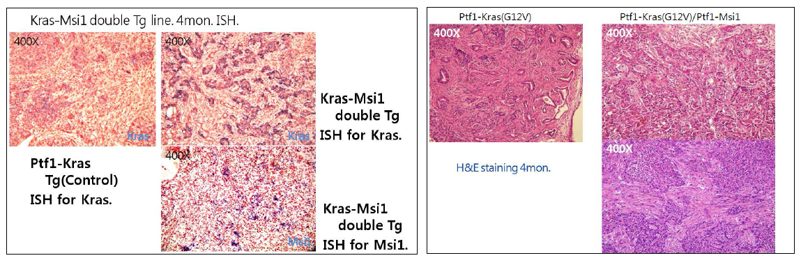 Msi1 발현주와 연구진이 기 보유중인 oncogenic Kras 발현주를 교배하여 이중형질 전환주에서 발생한 췌장암 모델. Kras single transgenic tumor에 비하여 분화도가 불량하고 aggressive tumor가 발생함.