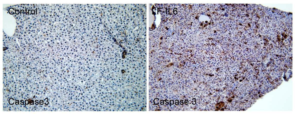 Caspase 3에 대한 면역염색. IL6 발현은 만성염증을 유발하여 세포사멸이 현저하게 증가시킴.