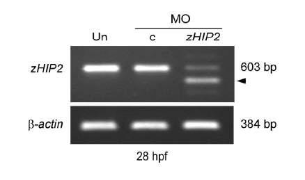 RT-PCR을 통한 zHIP2의 transcript양 감소와 비정상적인 splicing 절편의 형성 확인