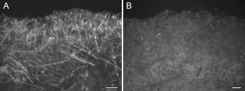 Immunofluorescence staining for TRPA 1 (A ) and the preabsorption test (B, 100 μg/ml) to check the specifity of the TRPA 1 antibody in the human dental pulp.