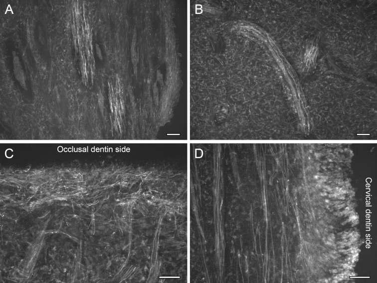 Immunofluorescent staining for TRPA1 in the radicular portion