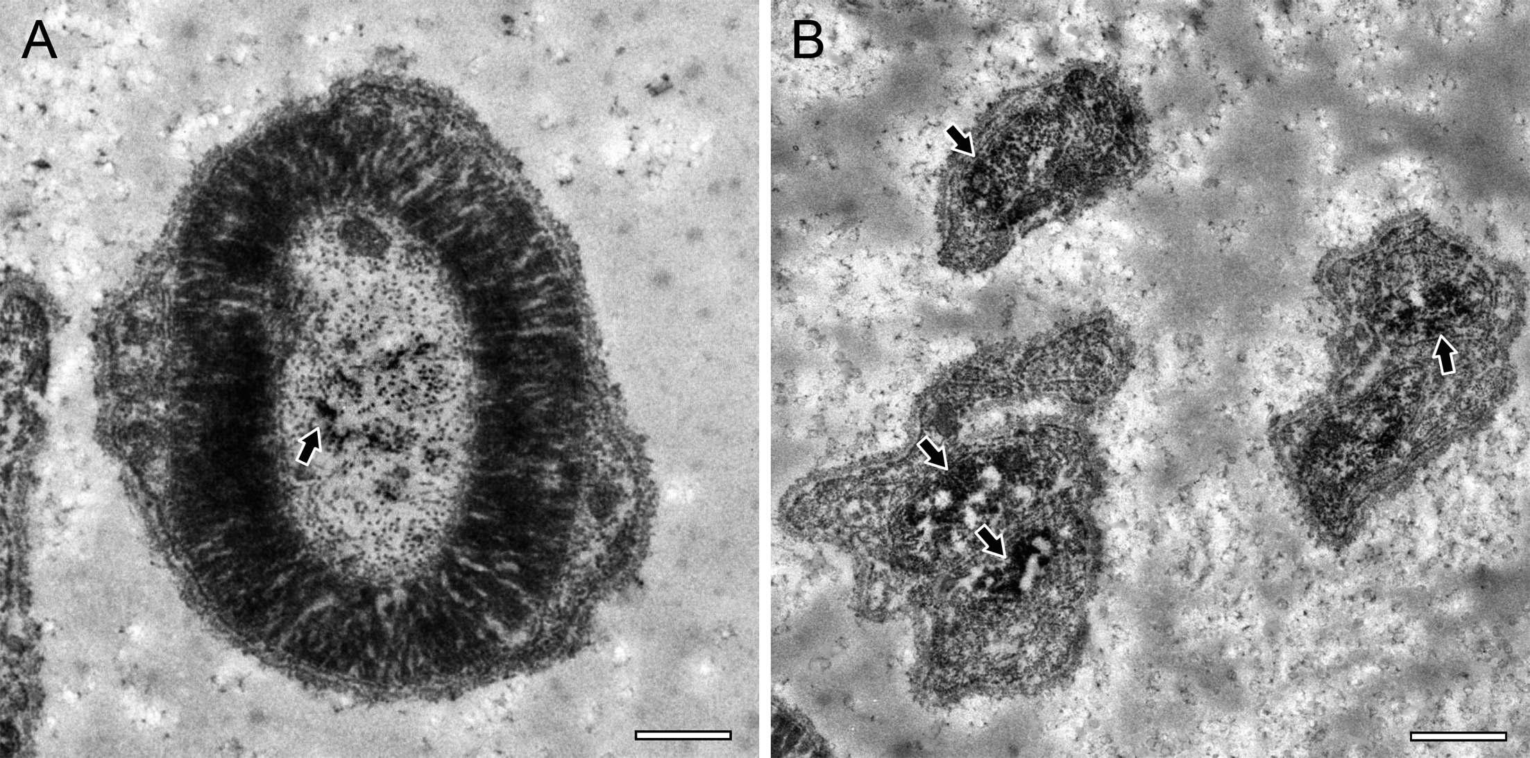 Electron micrographs showing immunoperoxidase staining for TRPA1 in the human normal dental pulp.