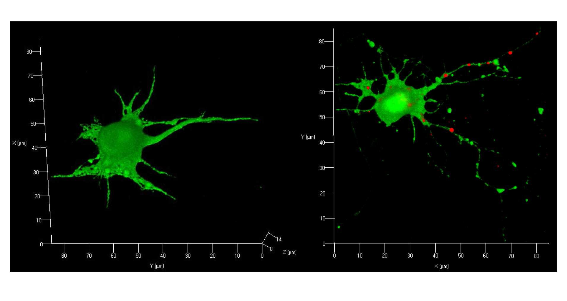 대뇌피질 신경세포에서 소포체(녹색) 및 mitochondria(적색)의 3차원 영상화