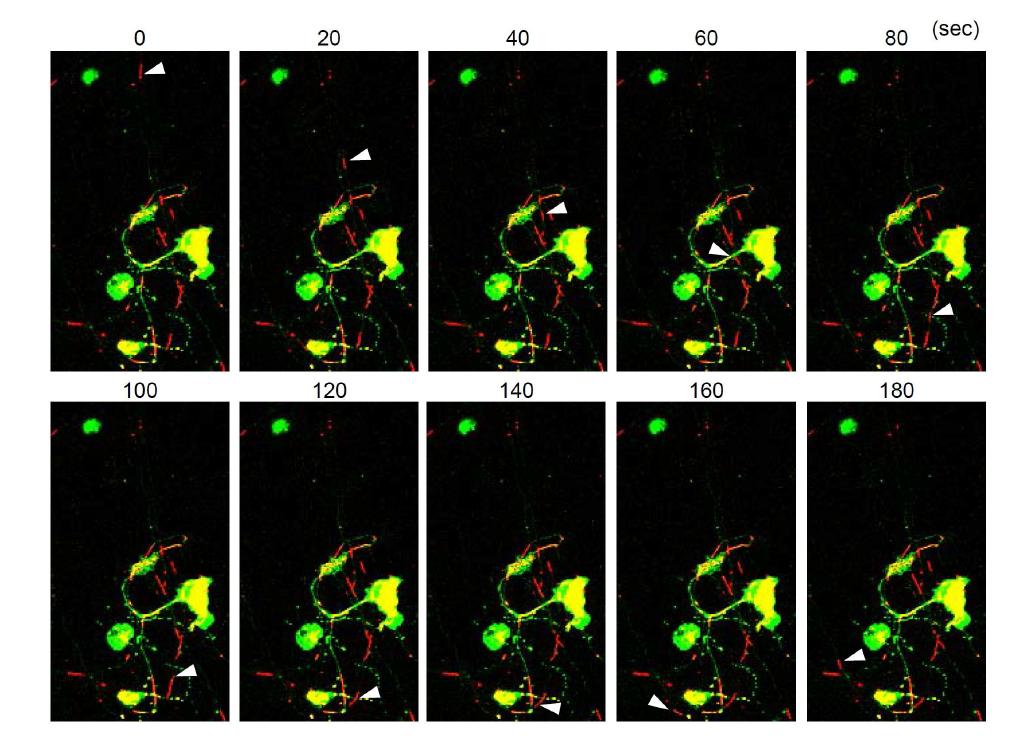 대뇌피질 신경세포에서 mitochondria(적색)의 역동적 이동양상 추적