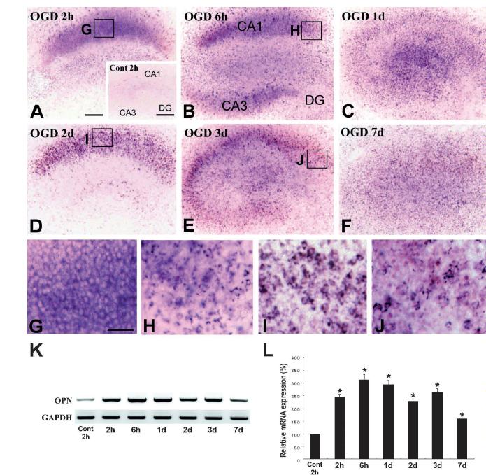 Temporal changes of OPN expression in org anotypic hippocampal slice cultures under control an d OGD conditions.