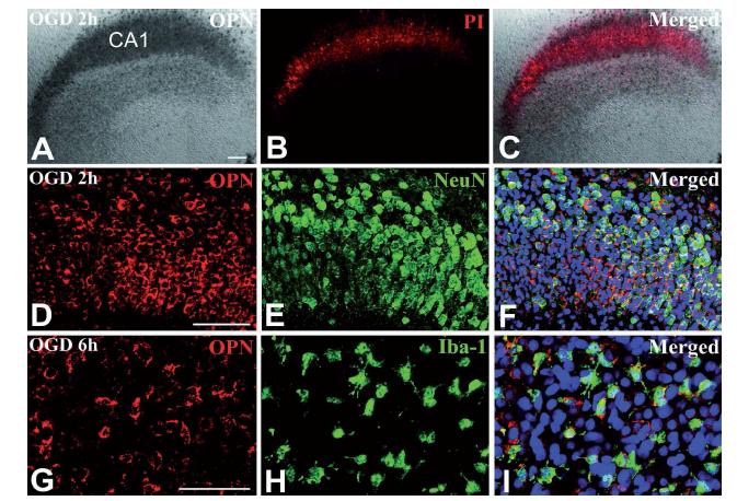 Identification of phenotypes of OPN-expressing cells in organotypic hippocampal slice cultures at 2 h (A)– (F) or 6 h (G)– (I) after OGD.