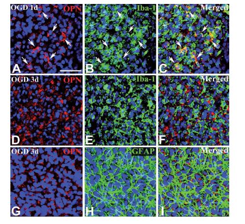 Identification of phenotypes of OPN-expressing cells in organotypic hippocampal slice cultures at d ay 1 [(A)– (C)] or day 3 [(D)– (I)] after OGD.