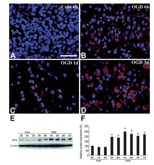 Temporal changes in OPN immunoreactivity in the CA1 region in organotypic hippocampal slice cu ltures under control and OGD conditions.