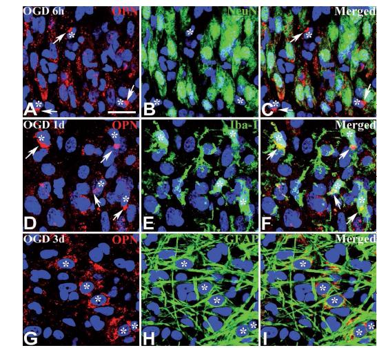 Identification of phenotypes of OPN-immunoreactive cells in the CA1 pyramidal cell layer in organotypic hippoca mpal slice cultures at 6 h [(A)– (C)], day 1 [(D)– (F)] or d ay 3 [(G)– (I)] after OGD.