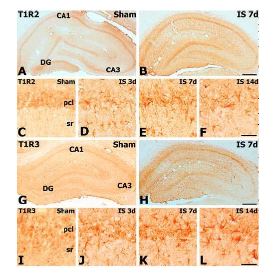 Changes in immunoreactivities for T1R2 (a– f) and T1 R3 (g– l) in the hippocampus after ischemia.