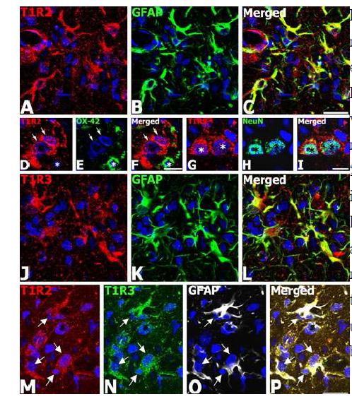 Identification of the phenotypes of T1R2 and T1R3 immu noreactive cells in the hippocampal CA1 region at day 7 after r eperfusion.