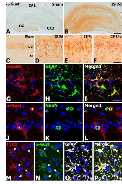 Temporal profiles and phenotypes of a-gustducin (a-Gust) im munoreactive cells in the hippocampus after ischemia.