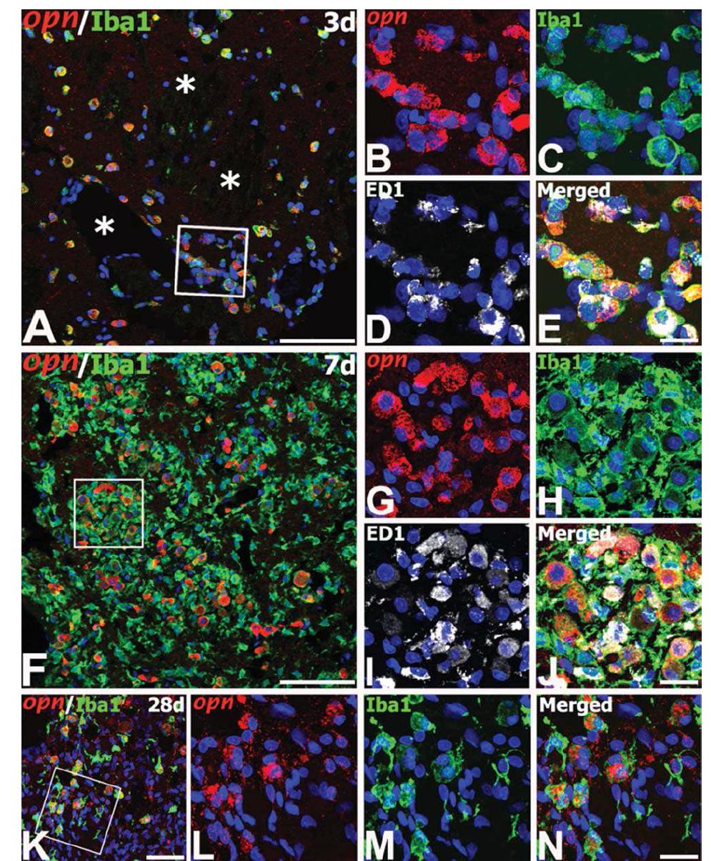 Spatiotemporal distribution and characterization of osteopontin (OPN) mRNA-expressing cells in th e core region of ischemic injury in the rat brain using in situ hybridization (for OPN) and immunolabeling (for proteins).