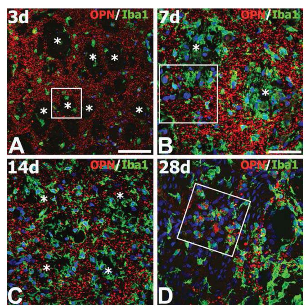 Spatiotemporal distribution of OPN protein in the core brain region of ischemic injury.