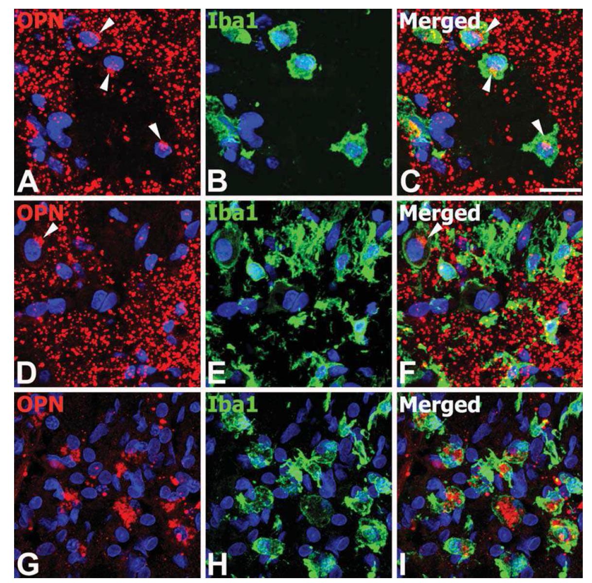 Characterization of OPN protein in the core region of ischemic injury.