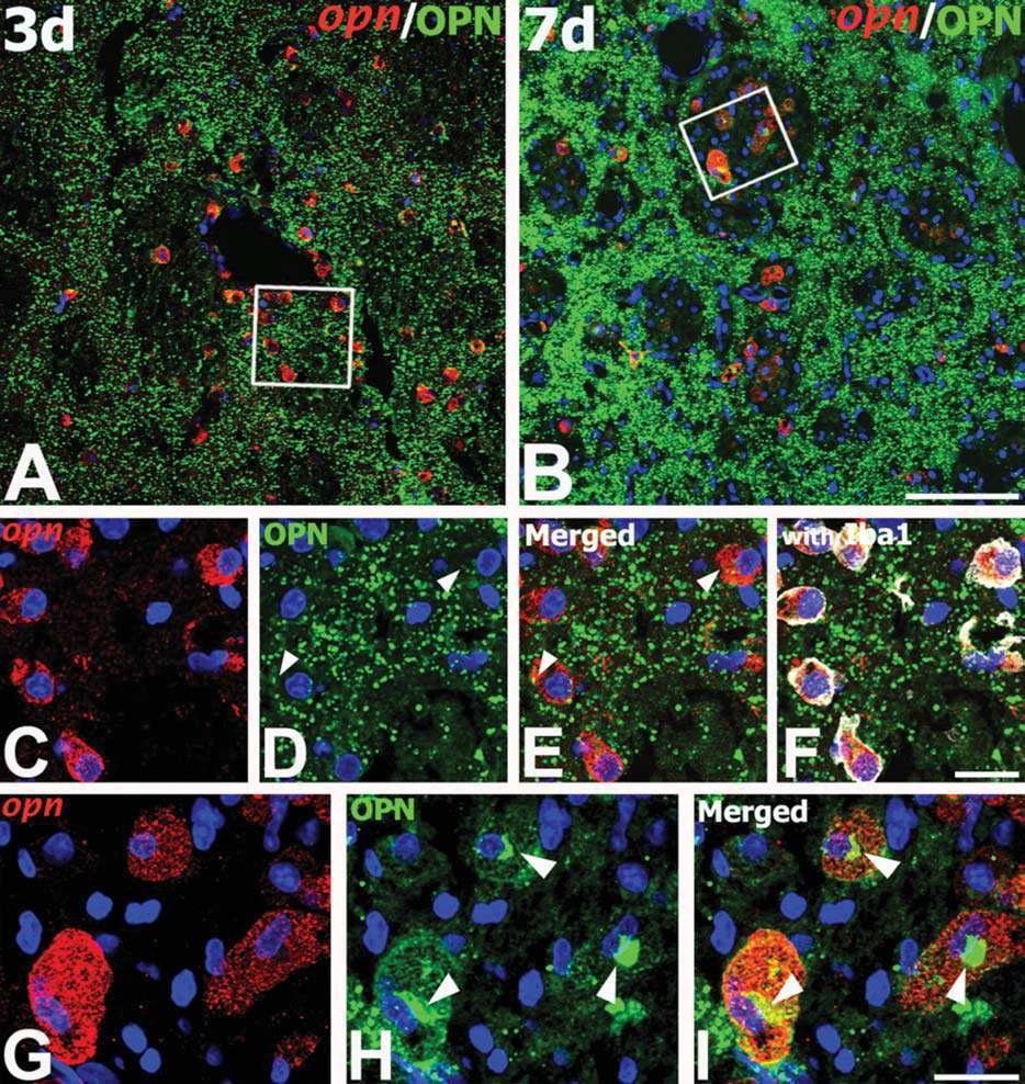 Spatiotemporal relationship of OPN mRNA and protein in the core region at days 3 (A, C– F) and 7 (B, G– I) after ischemic injury.