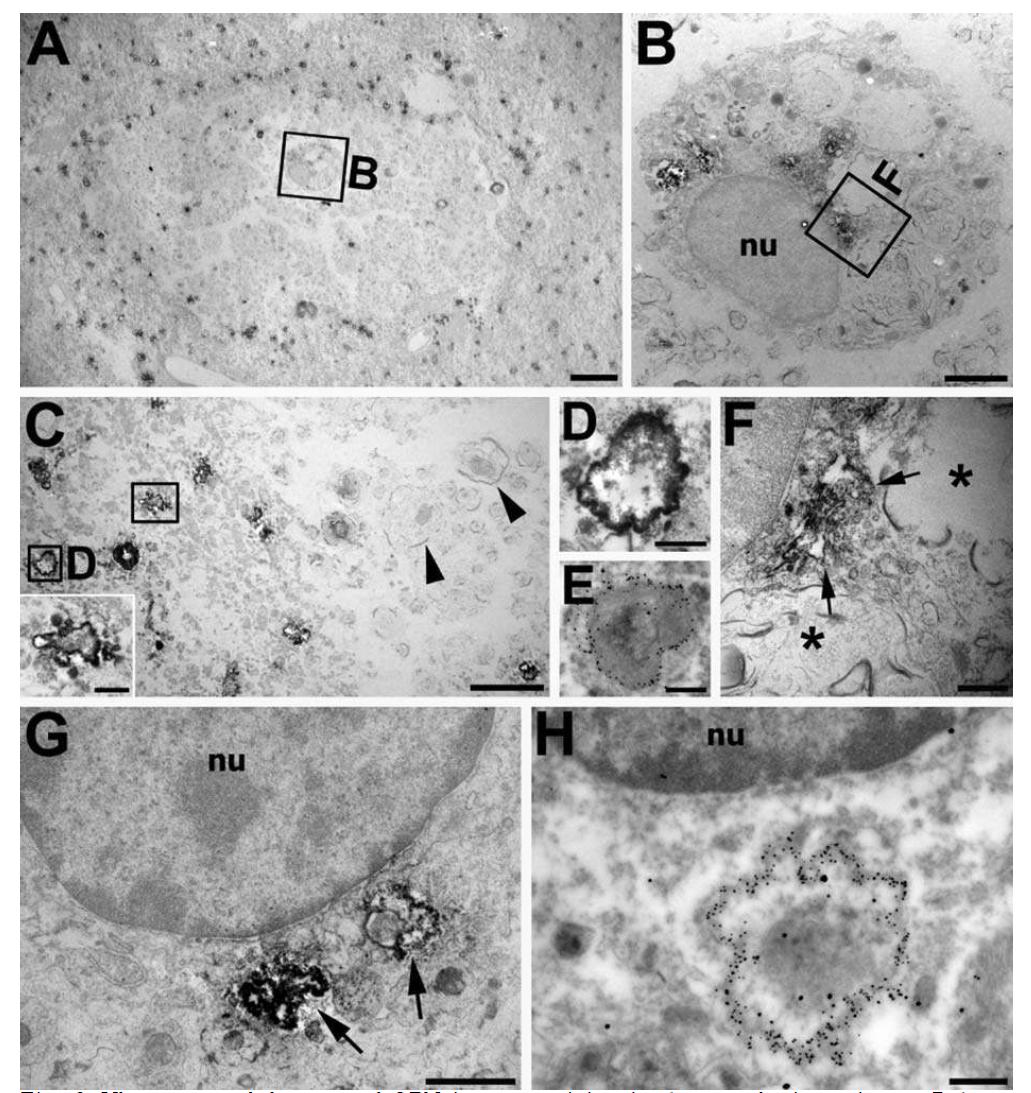 Ultrastructural features of OPN immunostaining in the core brain region at 7 days postischemia by using immunoperoxidase (A– D, F– G) and silver-enhanced immunogold (E, H) electron microscopy.