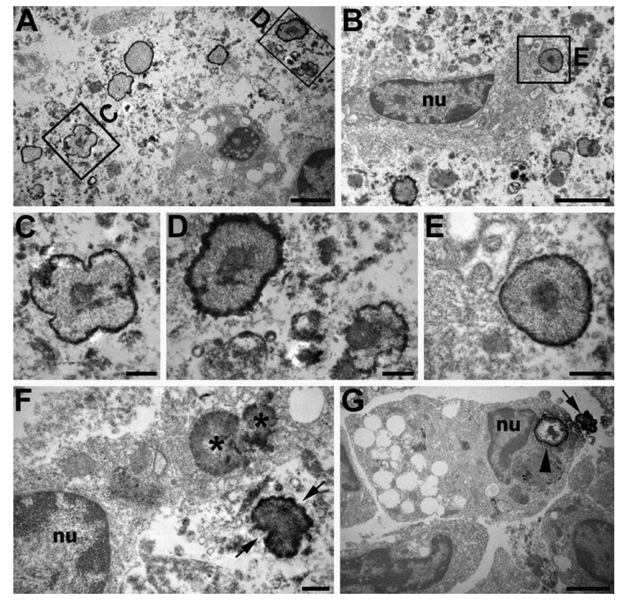 Ultrastructural features of OPN immunostaining in the core region at 28 days postischemia. (A) O PN-positive flakes were scattered among the microglia/macrophages in the infarction core.