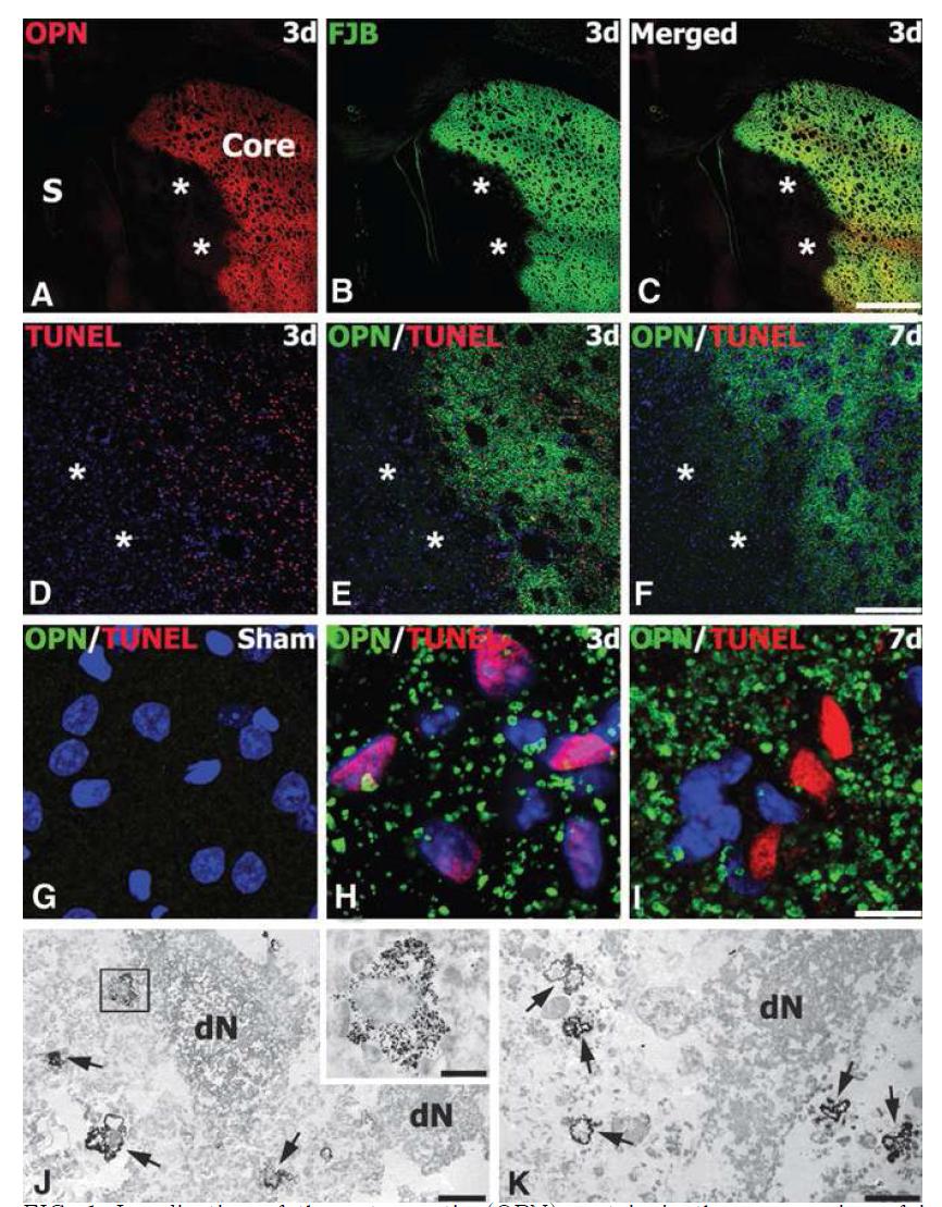 Localization of the osteopontin (OPN) protein in the core region of ischemic injury.