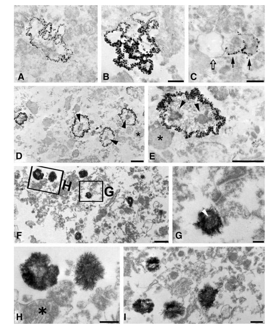 Ultrastructural localization of osteopontin (OPN) by the immunogold-silver method (A– E), and cal cium by the osmium/potassium dichromate method (F– I) in the core region of ischemic injury at days 7 (A– C) and 14 (D– I).