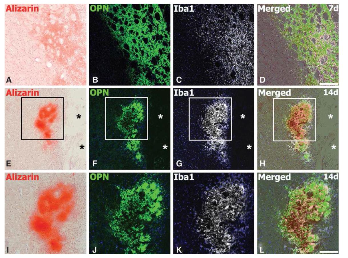 Spatiotemporal relationship of osteopontin (OPN), Iba1, and alizarin red staining in the core region at days 7 (A– D) and 14 (E– L) after ischemic injury.