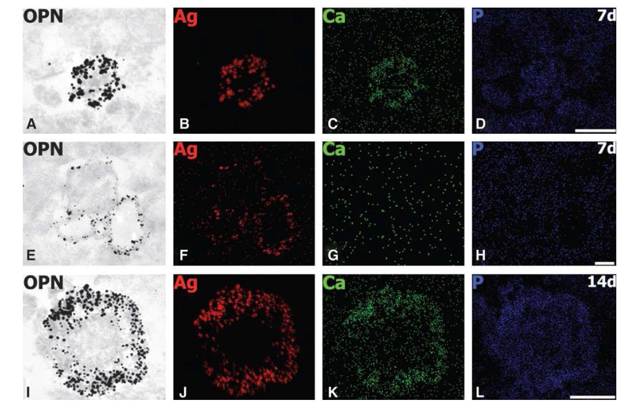 Transmission electron microscopy (TEM) images and corresponding compositional images of an id entical ultrathin section from the core region at postischemia days 7 (A– H) and 14 (I– L).